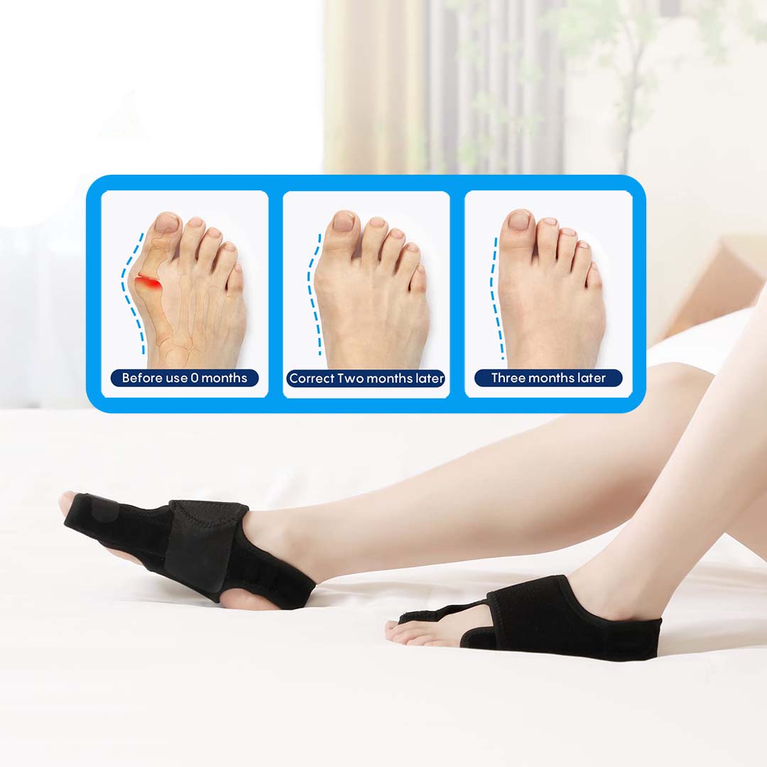 FlexiToe™️ - Orthopedic Bunion Corrector